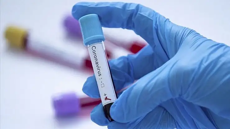 COVİD-19 SEROPREVALANS ARAŞTIRMASININ İKİNCİSİ BAŞLADI