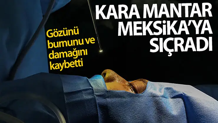 Kara mantar hastalığı Meksika'ya da sıçradı