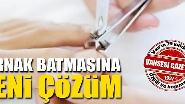 Tırnak batmasına yeni çözüm