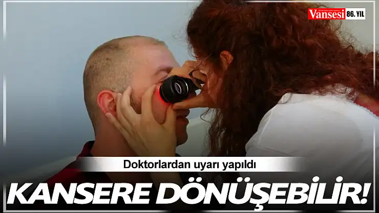 Doktorlardan uyarı yapıldı! Kansere dönüşebilir
