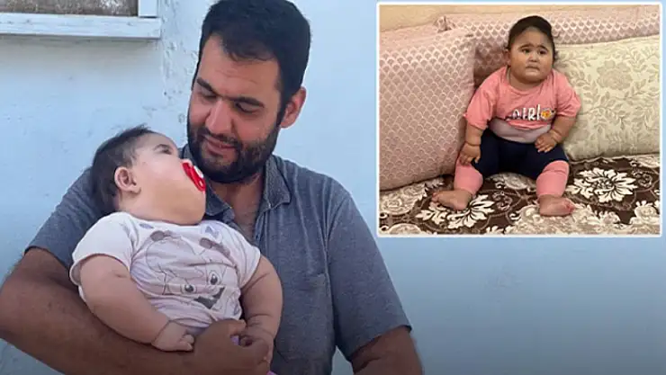 Gülistan bebek hızla kilo alıyor! 11 ayda 20 kilo