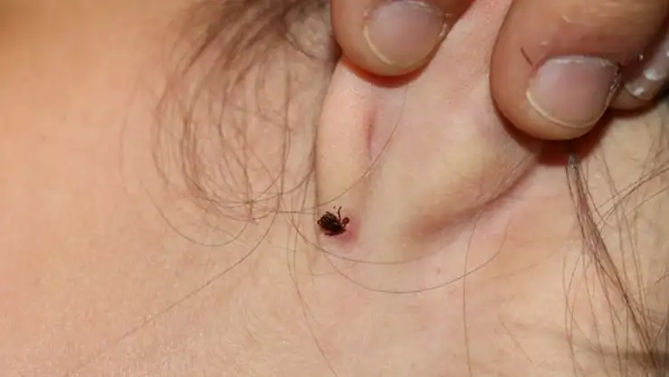 Havaların ısınmasıyla birlikte kenelerle temas riski arttı