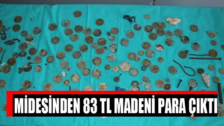 Midesinden 83 TL madeni para çıktı