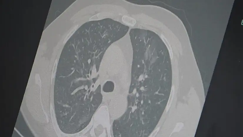 Profesör uyardı: 3'lü salgına dikkat!