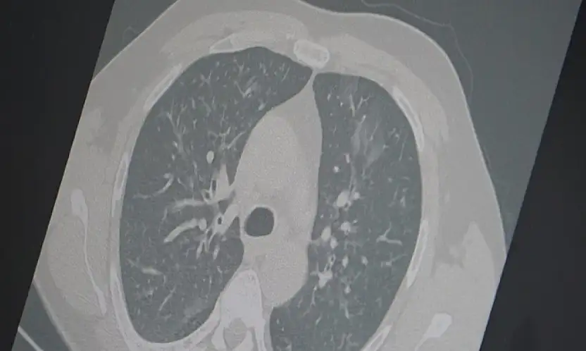 Profesör uyardı: 3'lü salgına dikkat!