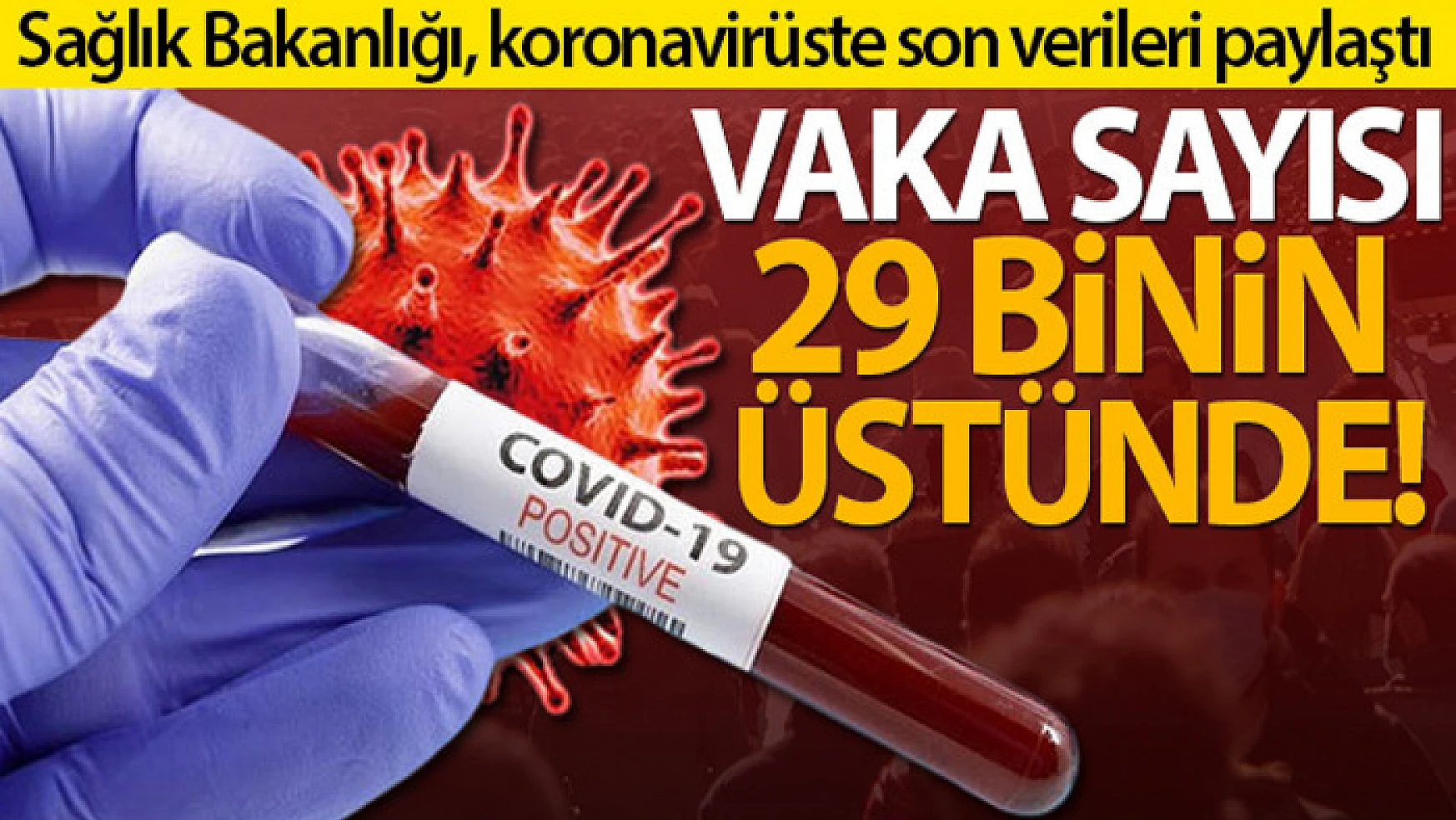 Türkiye'de son 24 saatte 29.081 koronavirüs vakası tespit edildi